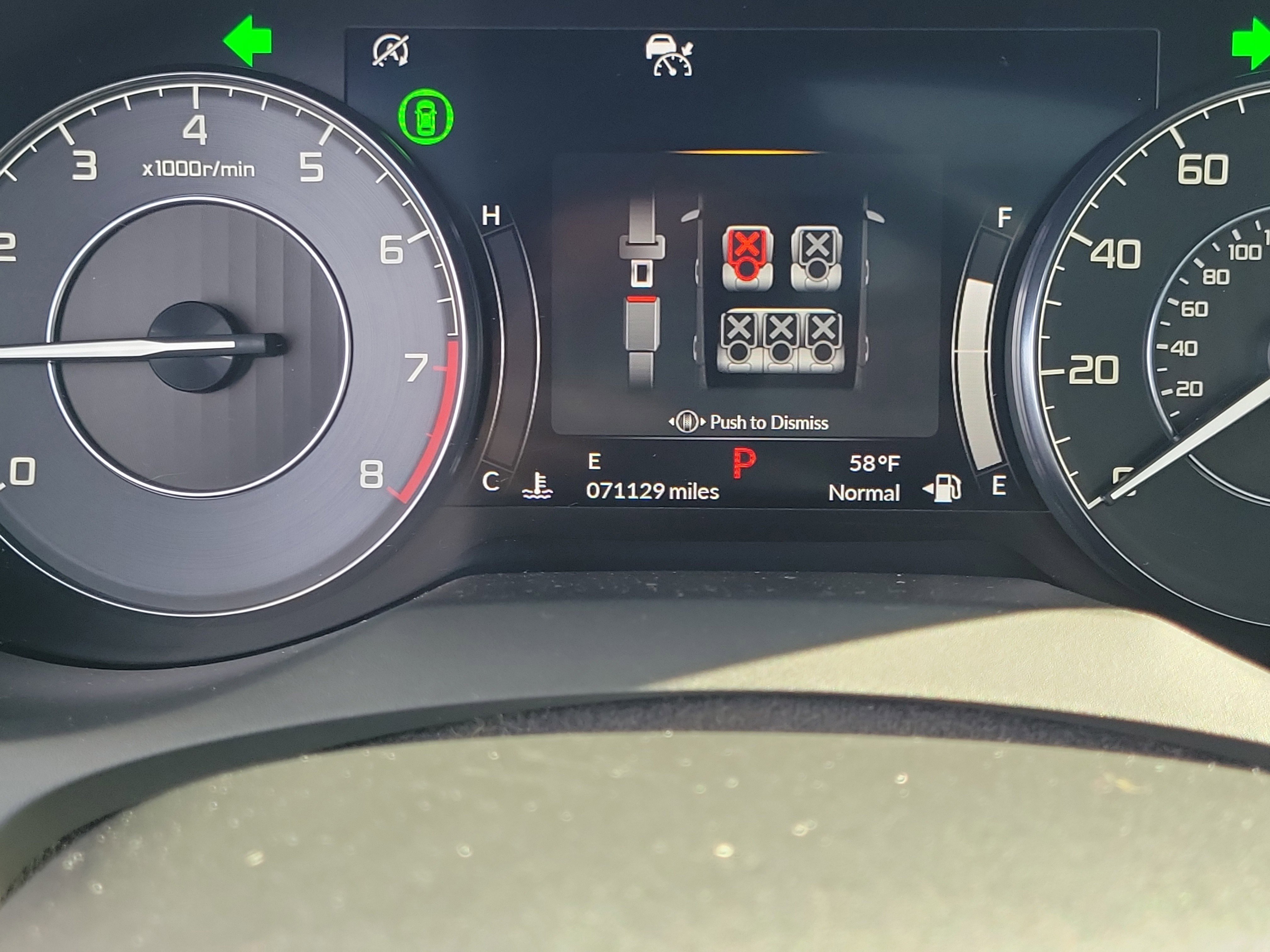 2022 Acura RDX Advance Image 17 of 30