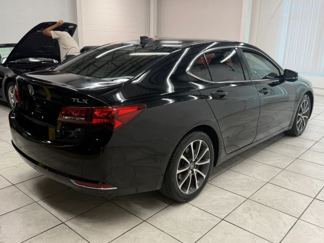 2015 Acura TLX V6 Technology