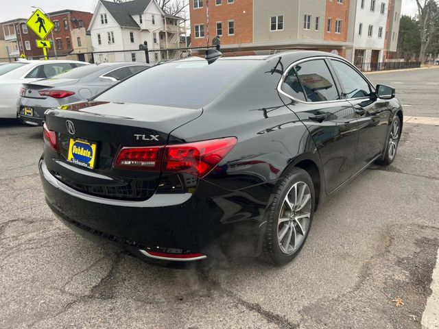 2015 Acura TLX V6