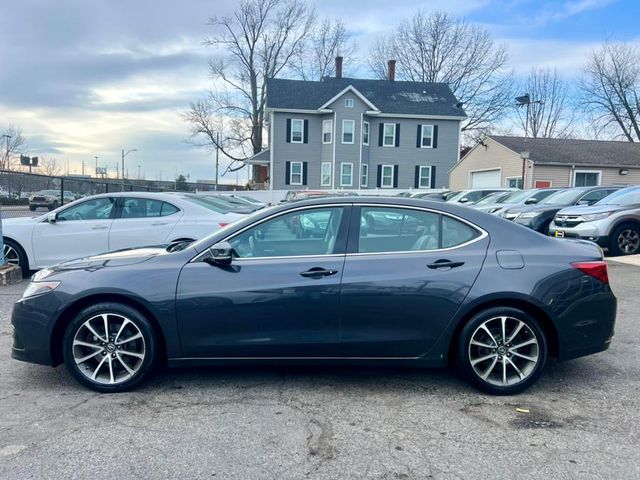 2015 Acura TLX V6 Technology