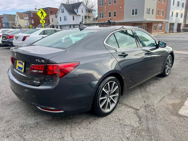 2015 Acura TLX V6 Technology