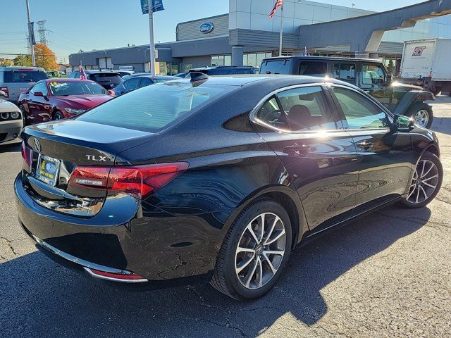 2015 Acura TLX V6 Advance