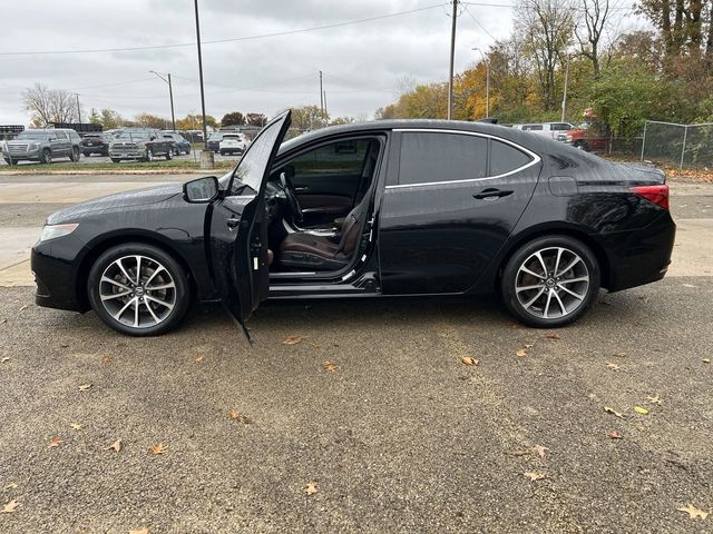 2015 Acura TLX V6 Technology