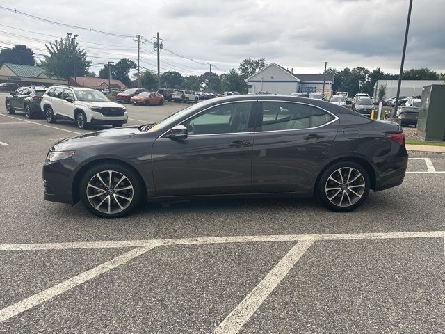 2015 Acura TLX V6 Technology