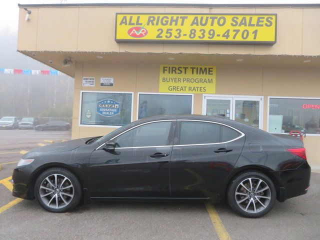 2015 Acura TLX V6 Technology