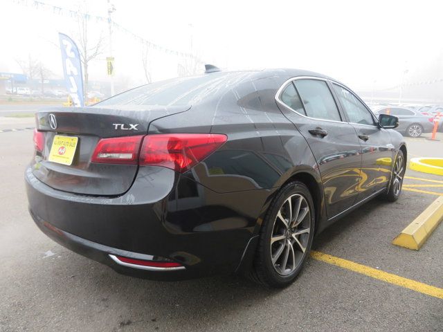 2015 Acura TLX V6 Technology