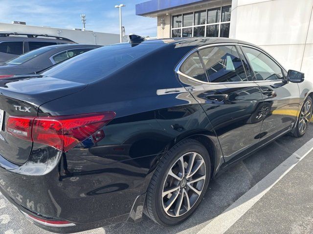 2015 Acura TLX V6 Technology