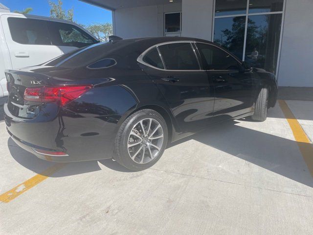 2015 Acura TLX V6 Technology