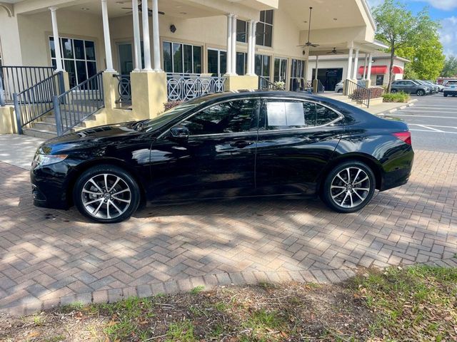 2016 Acura TLX V6 Advance