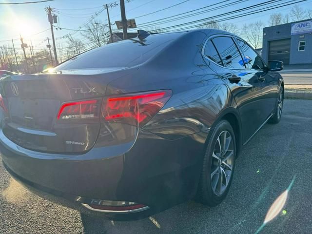 2016 Acura TLX V6 Technology