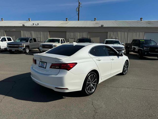 2016 Acura TLX V6