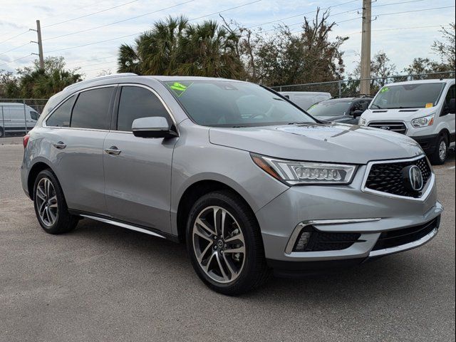 2017 Acura MDX Advance