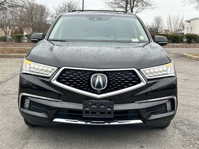 2017 Acura MDX Advance