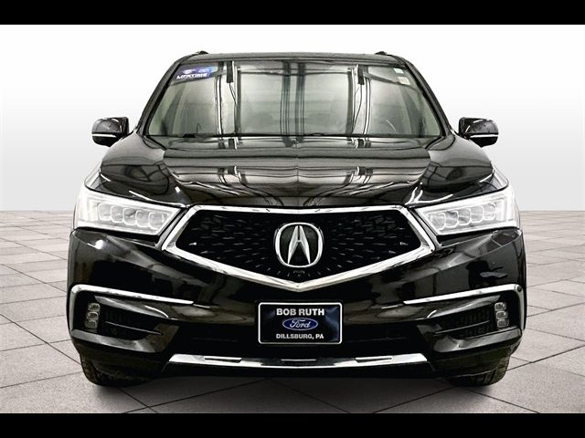 2017 Acura MDX Advance