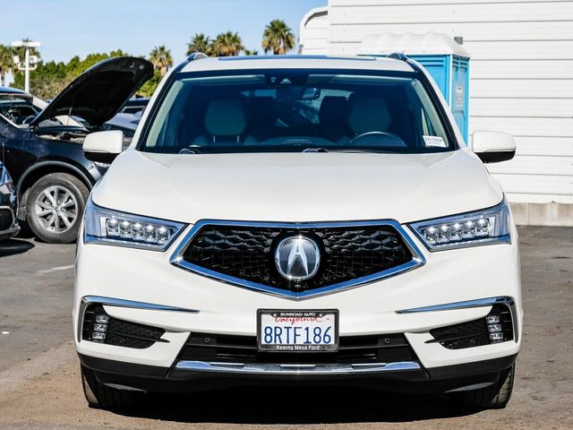 2017 Acura MDX Advance