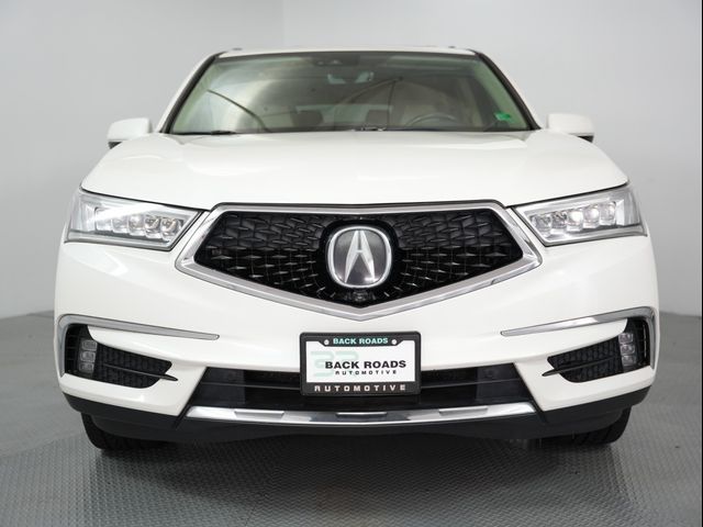 2017 Acura MDX Advance
