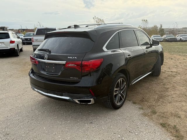 2017 Acura MDX Advance