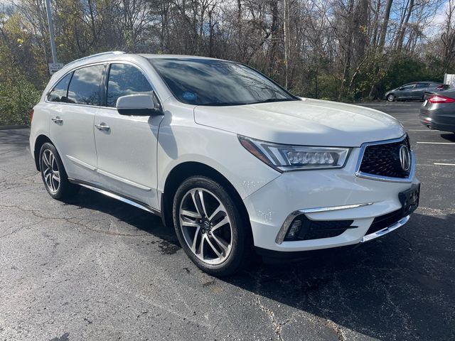 2017 Acura MDX Advance