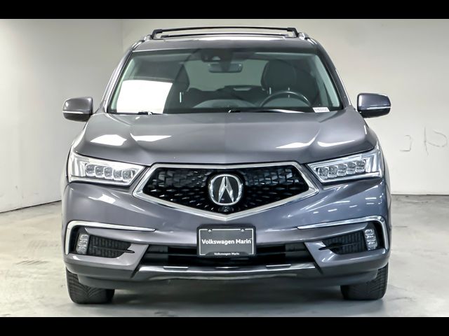 2017 Acura MDX Advance