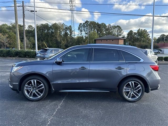 2017 Acura MDX Advance