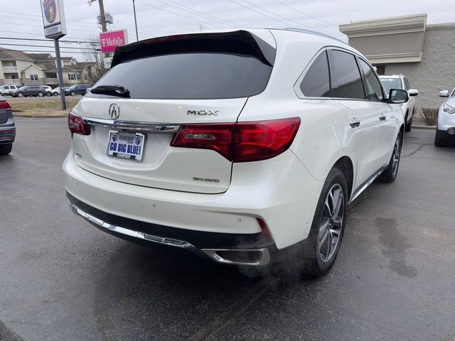 2017 Acura MDX Advance