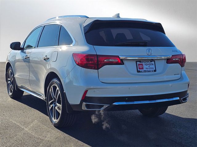 2017 Acura MDX Advance