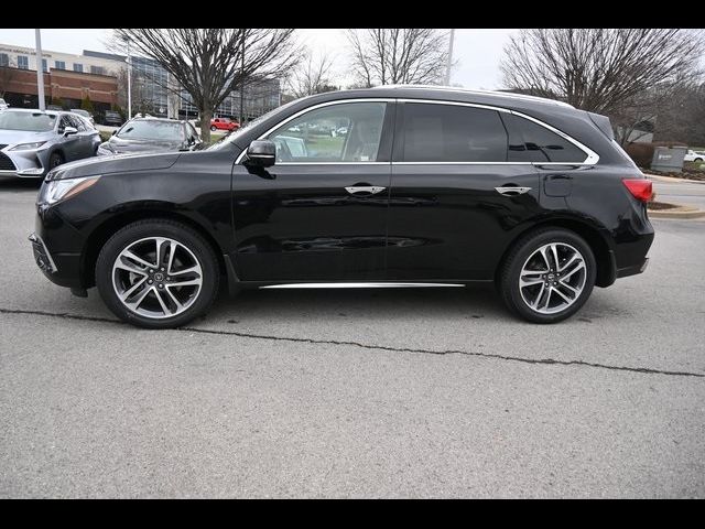 2017 Acura MDX Advance