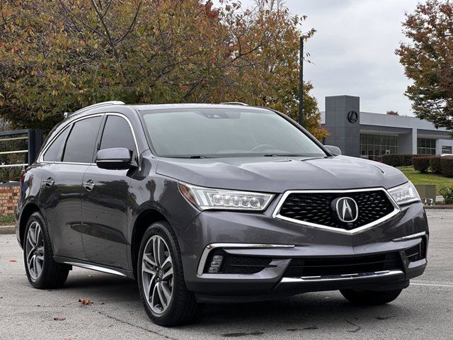 2017 Acura MDX Advance