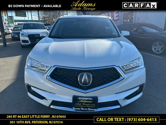 2017 Acura MDX Advance