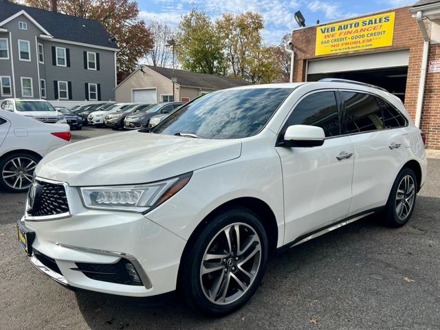 2017 Acura MDX Advance