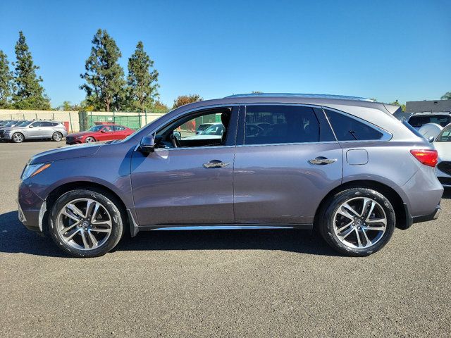 2017 Acura MDX Advance