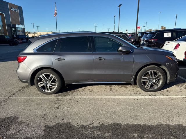 2017 Acura MDX Advance