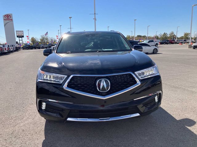 2017 Acura MDX Advance