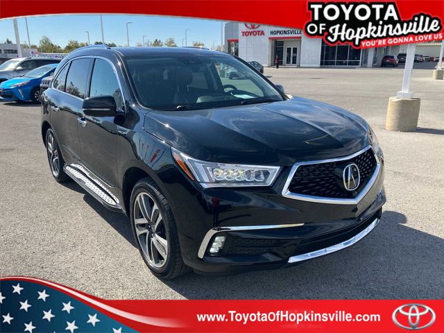 2017 Acura MDX Advance