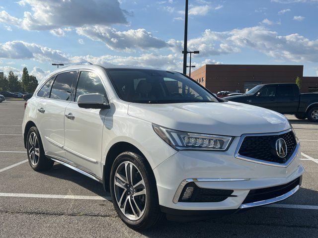 2017 Acura MDX Advance