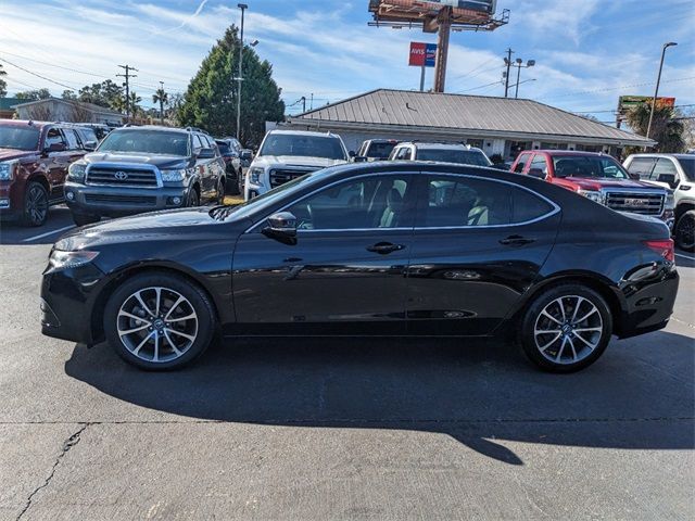 2017 Acura TLX V6 Technology