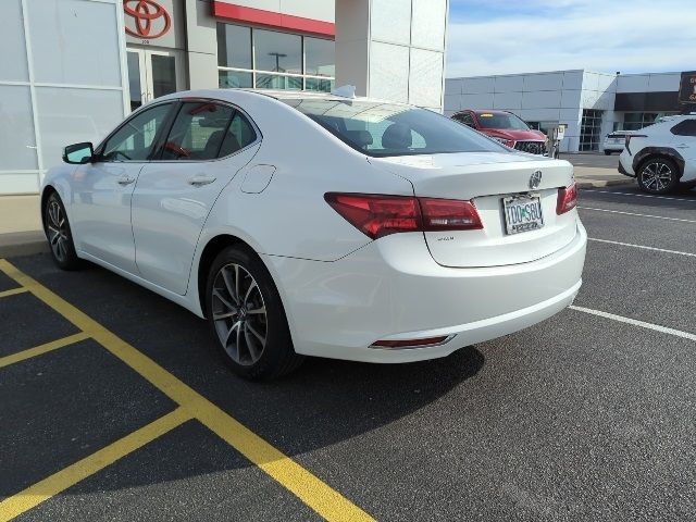 2017 Acura TLX V6 Technology