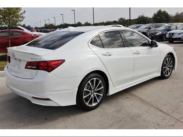 2017 Acura TLX V6 Advance