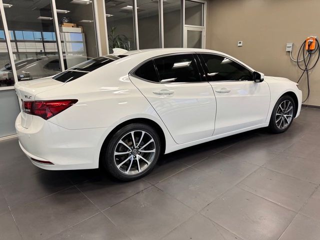 2017 Acura TLX V6 Advance