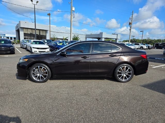 2017 Acura TLX V6 Advance