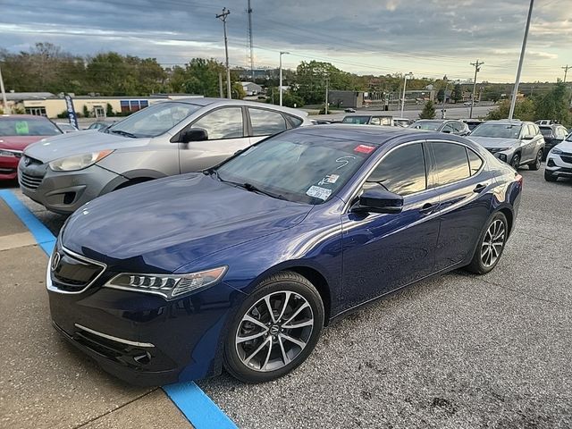 2017 Acura TLX V6 Advance