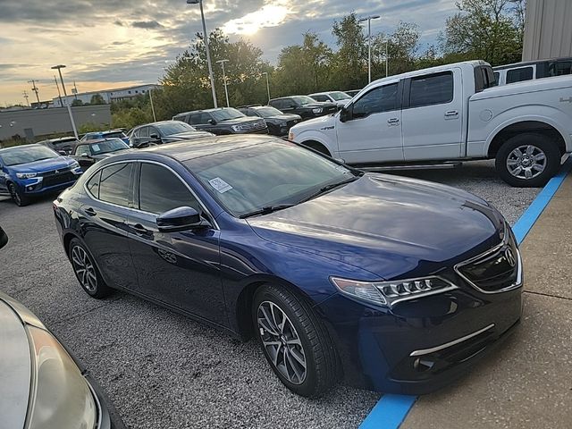 2017 Acura TLX V6 Advance