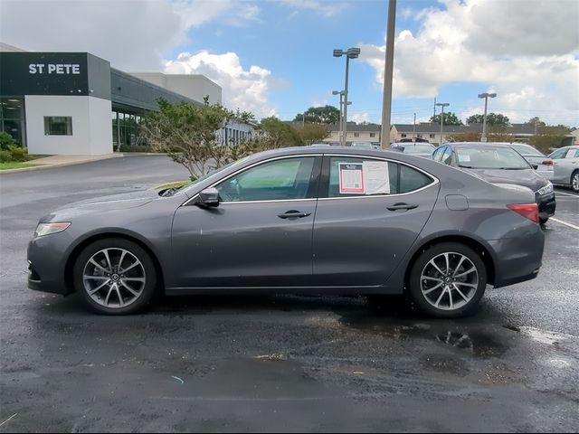 2017 Acura TLX V6 Advance