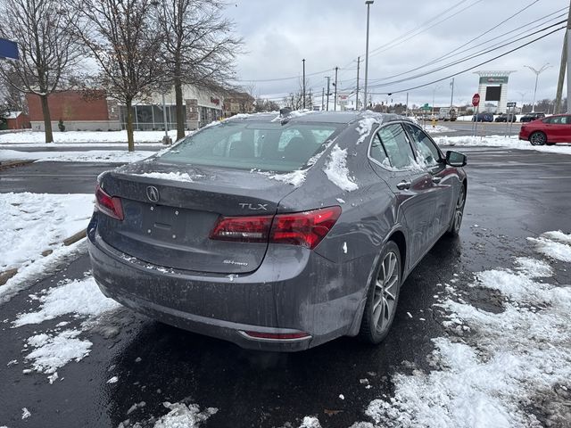 2017 Acura TLX V6 Advance