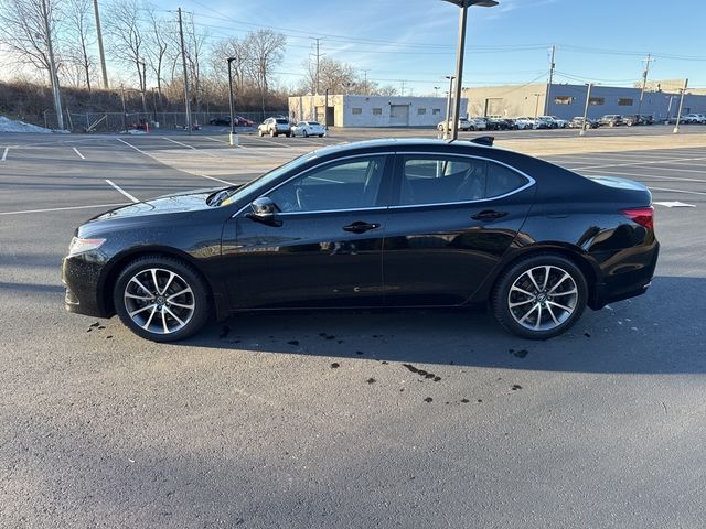 2017 Acura TLX V6 Advance