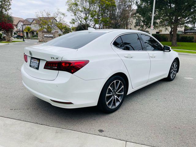 2017 Acura TLX V6 Advance