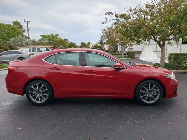 2017 Acura TLX V6 Technology