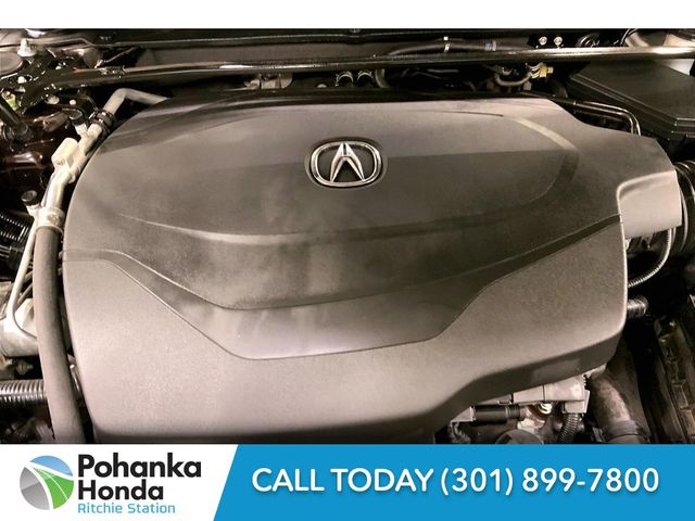 2017 Acura TLX V6 Technology