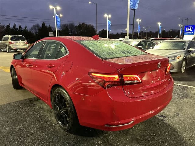 2017 Acura TLX V6 Advance