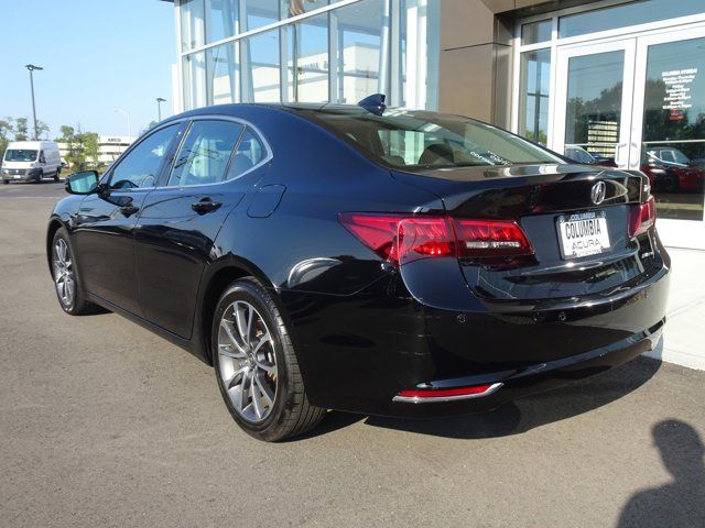 2017 Acura TLX V6 Advance